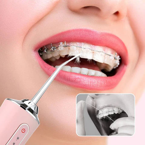 OralPure - IRRIGADOR ORAL PROFESIONAL PARA UNA HIGIENE IMPECABLE