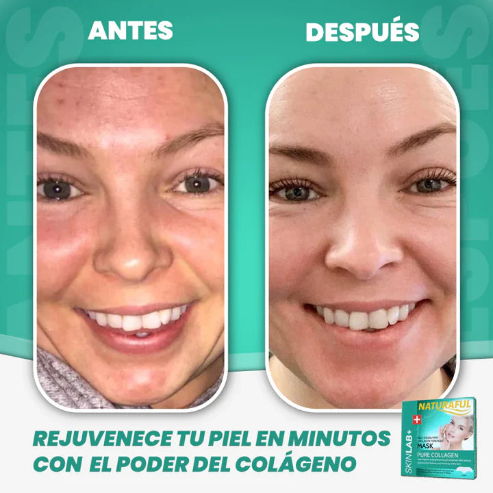 COLLAGEN PLUS 12 PARCHES® -  2X1 DE BELLEZA INSTANTÁNEA